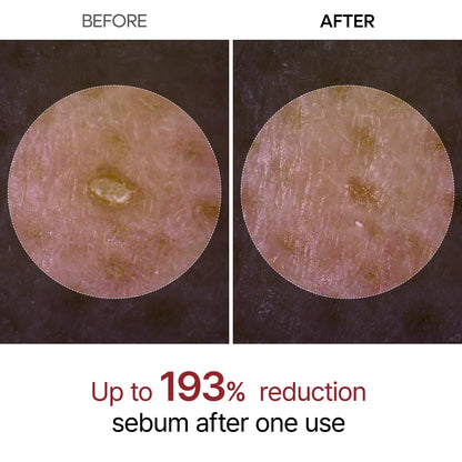 Dr.Melaxin Peel Shot Exfoliating Black Rice Ampoule